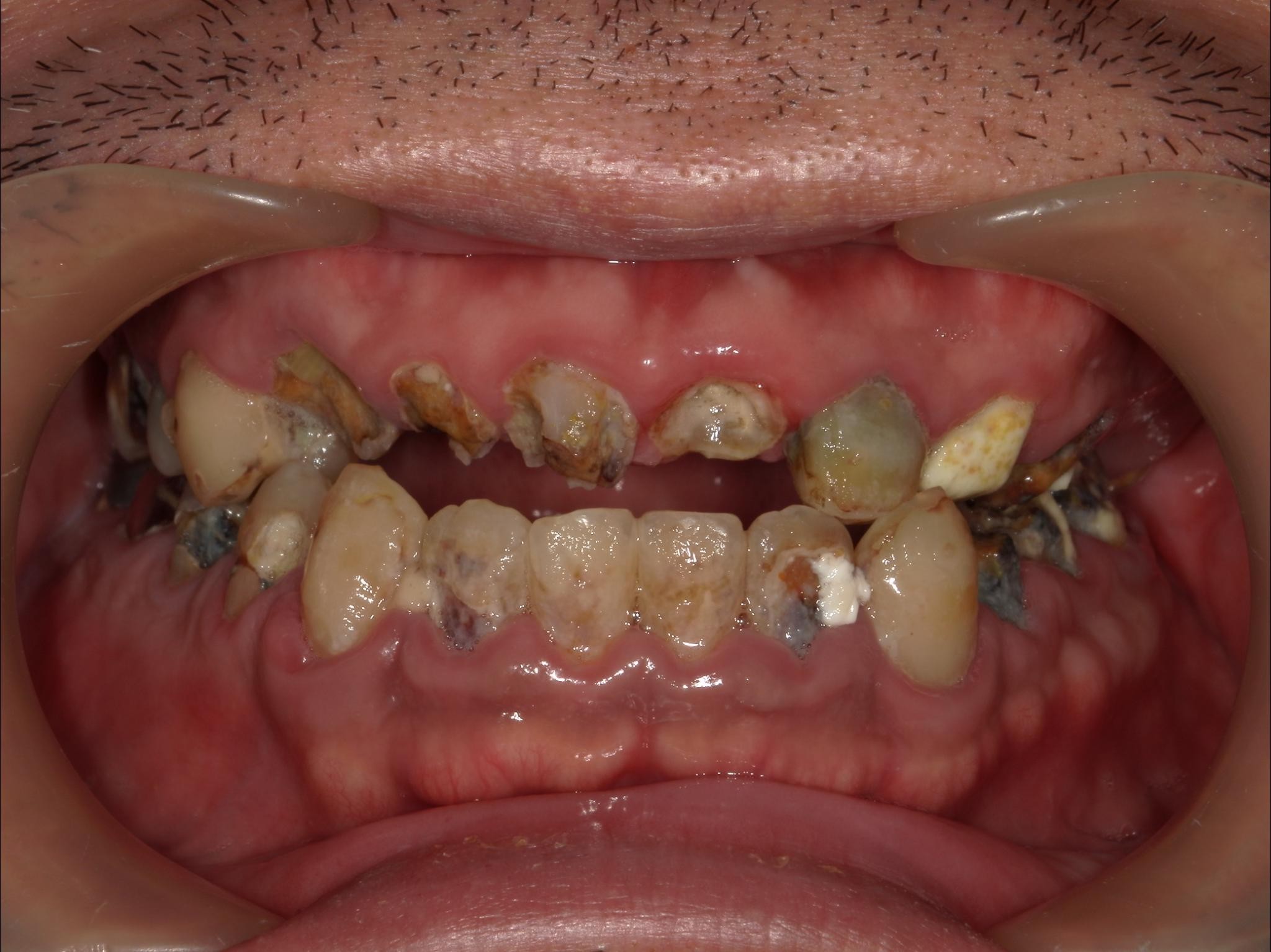 Before