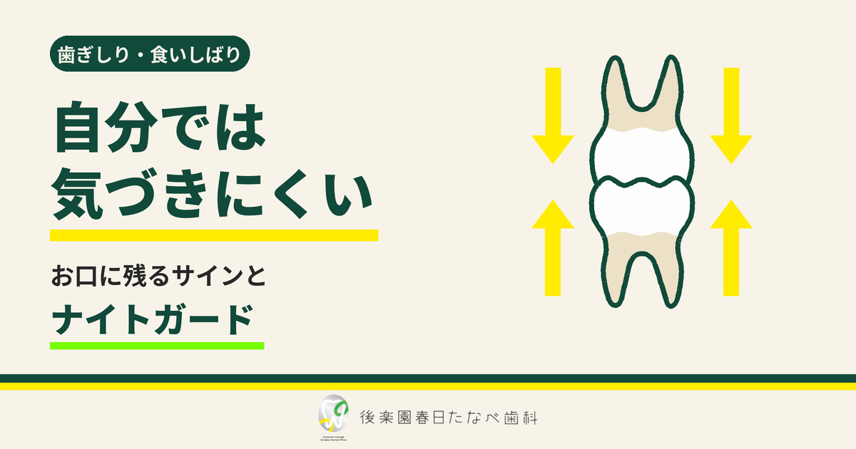 春日・後楽園の歯医者 後楽園春日たなべ歯科 歯ぎしり・食いしばりのサインとナイトガード
