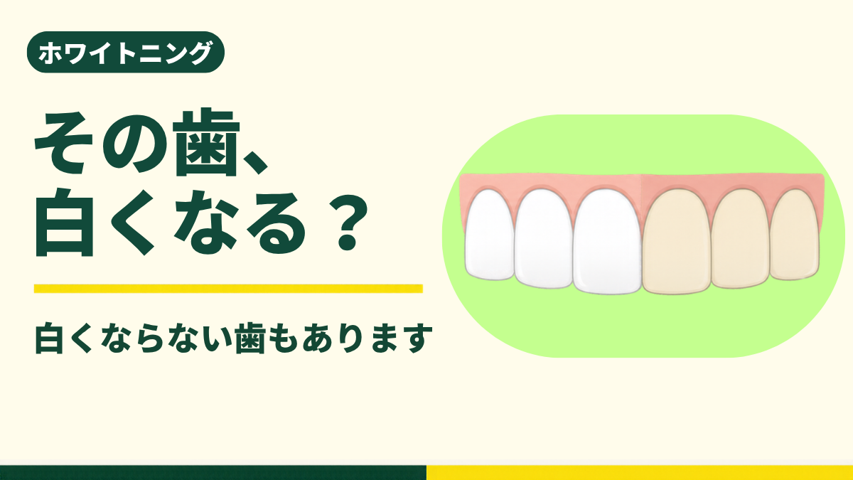春日・後楽園の歯医者 後楽園春日たなべ歯科 ホワイトニングで白くなる歯とならない歯